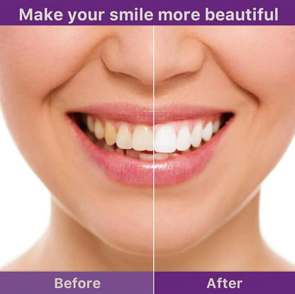 Bright Smile Powder